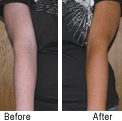 Adonia Sunless Tanner Before and After